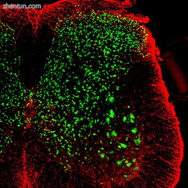 Cross-section of adult mouse spinal cord.jpg