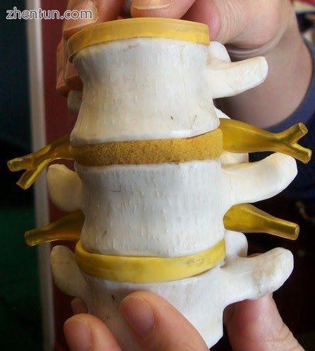 A model of segments of the human spine and spinal cord, nerve roots can be seen .jpg