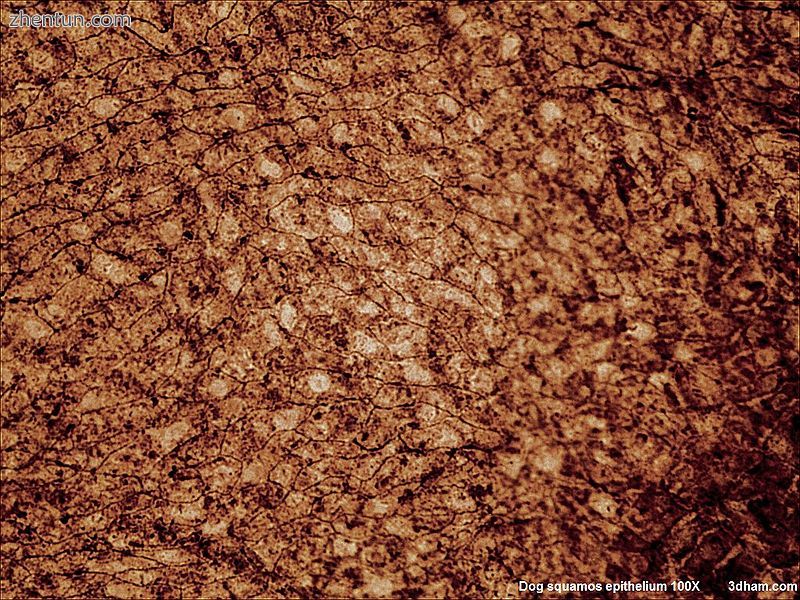 Squamous Epithelium 100x.jpg