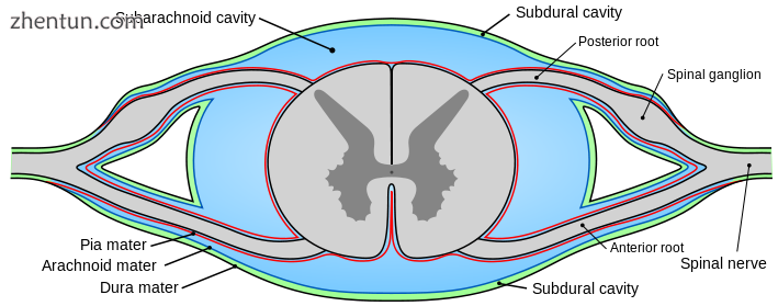 Diagram of section of spinal cord showing the meninges and spaces. Subarachnoid .png