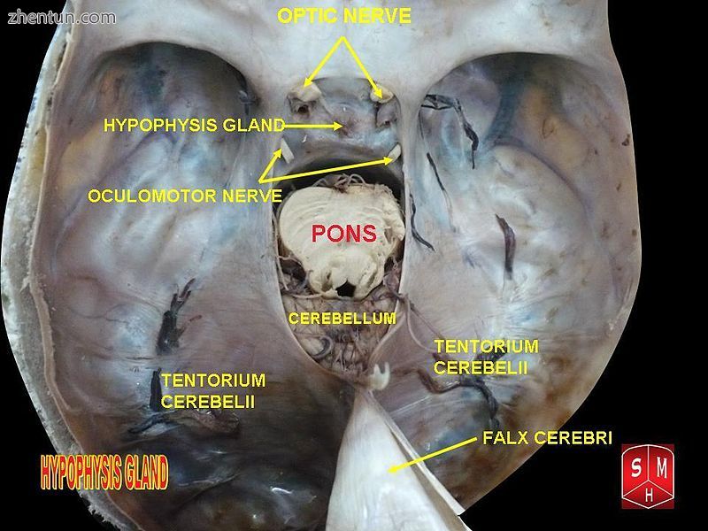 Pituitary gland.jpg