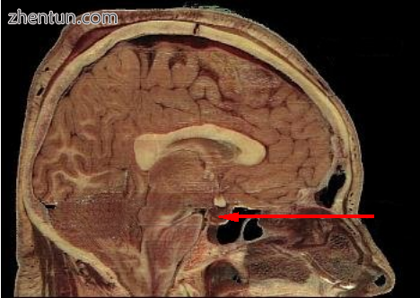 Location of the pituitary gland in the human brain.png