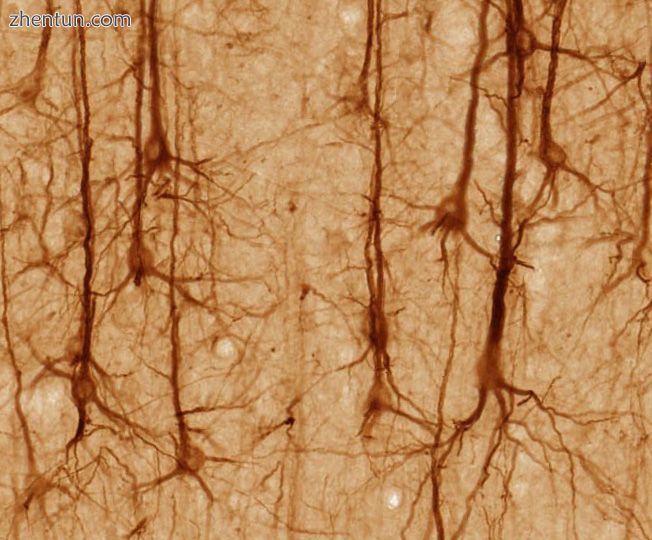 SMI32-stained pyramidal neurons in cerebral cortex.jpg