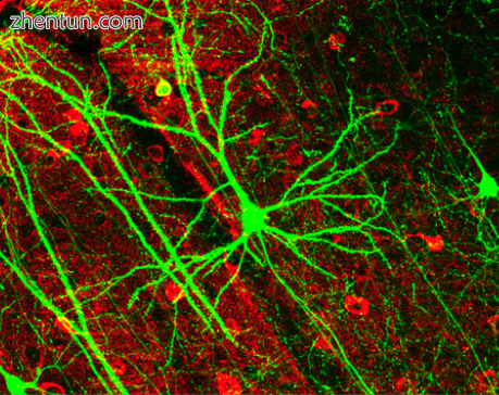 Image of pyramidal neurons in mouse cerebral cortex expressing green fluorescent.png