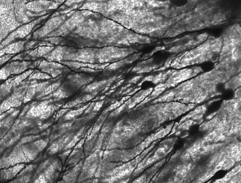 Golgi-stained neurons in human hippocampal tissue.jpg