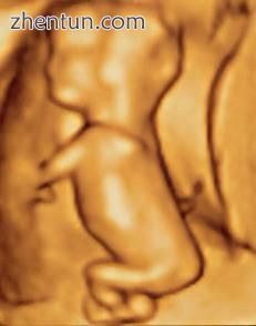 3D ultrasound of 3-inch (76 mm) fetus (about 14 weeks gestational age).jpg