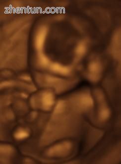 Fetus at 17 weeks.jpg