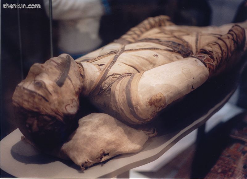 Egyptian mummy in the British Museum – tubercular decay has been found in the spine..jpg