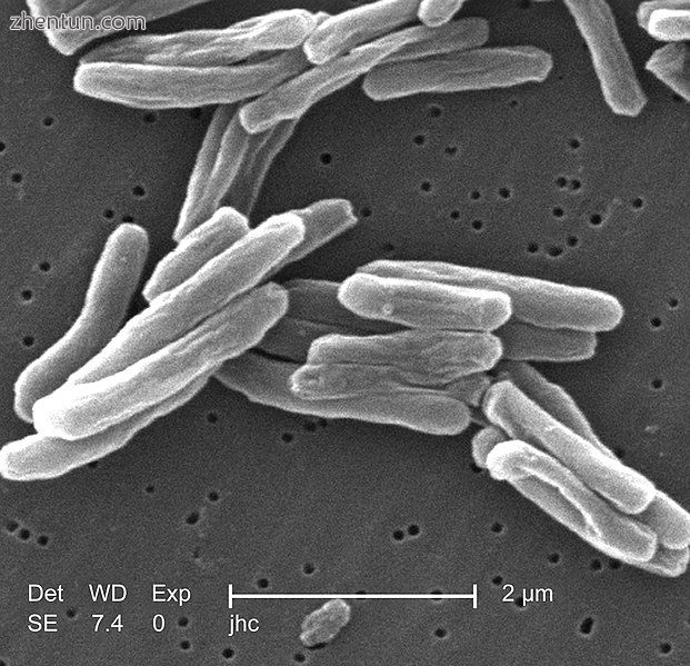 Scanning electron micrograph of M. tuberculosis.jpg