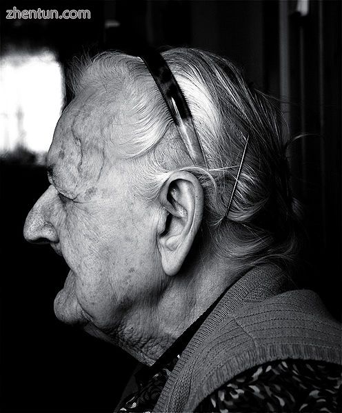 Enlarged ears and noses of old humans are sometimes blamed on continual cartilag.jpg