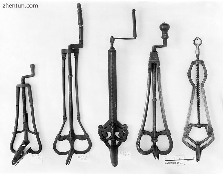 14th, 15th and 16th century specula.jpg