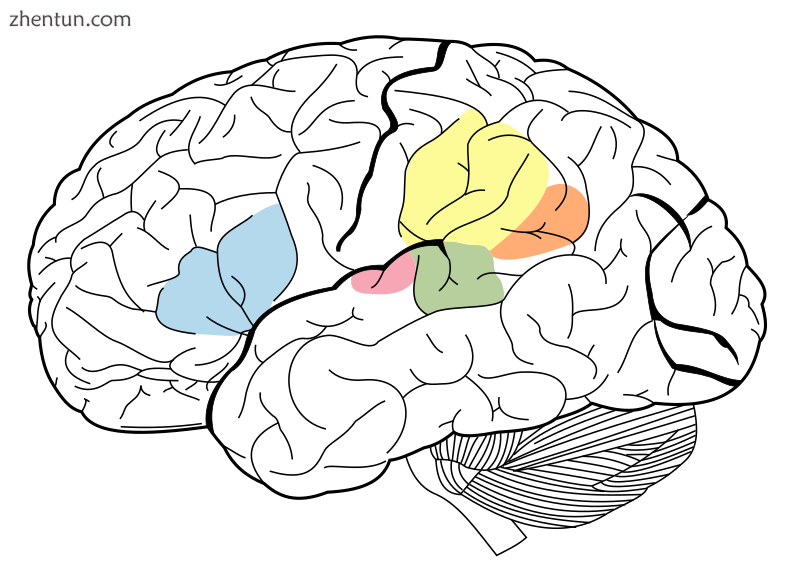 Diagram of human brain showing surface gyri and the primary auditory cortex.png