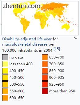 Disability-adjusted life year for musculoskeletal diseases per 100,000 inhabitan.jpg