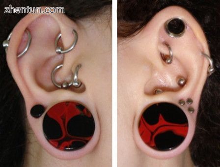 Stretching of the earlobe and various cartilage piercings.jpg