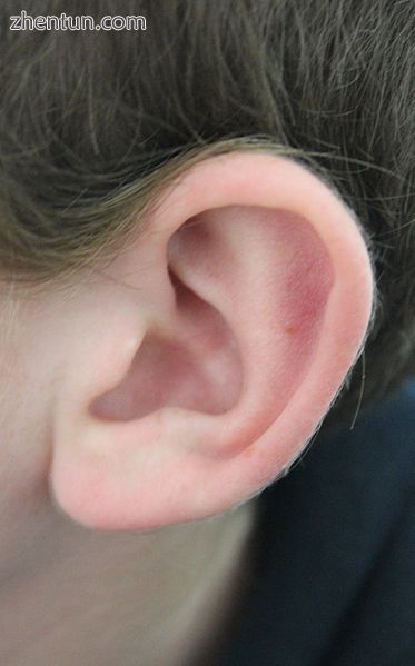 The outer portion of the human ear.JPG