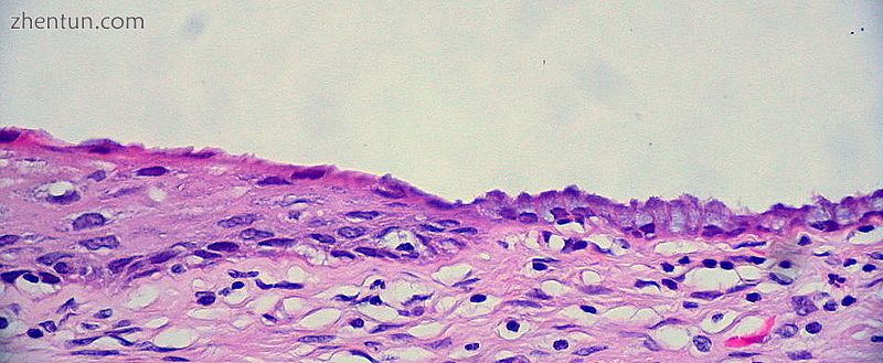 The squamocolumnar junction of the cervix.jpg
