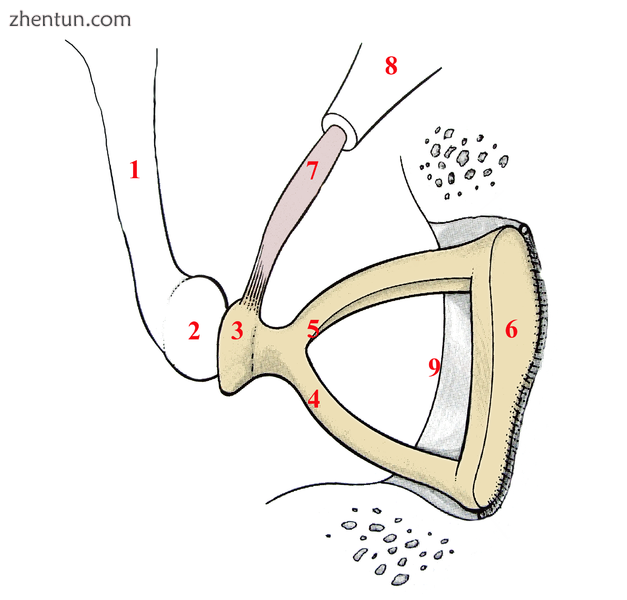 Right-ear stapes.png