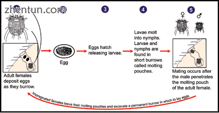 Life cycle of scabies[15].png