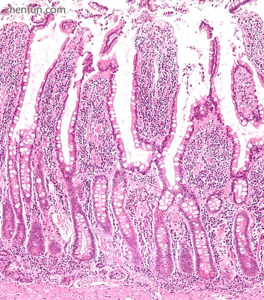 Micrograph of the small intestine mucosa showing the intestinal villi and crypts.jpg