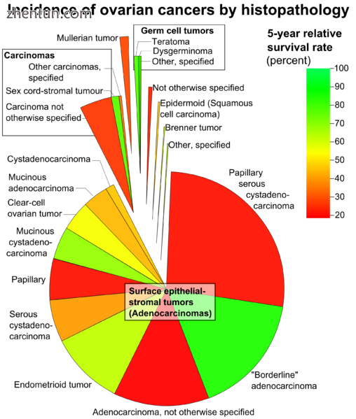 Ovarian cancers in women aged 20 , with area representing relative incidence and.png