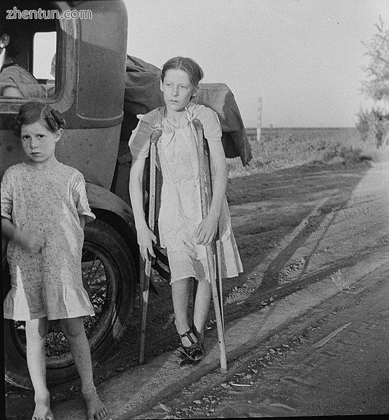 A girl from Oklahoma, who has been affected by bone tuberculosis, 1935.jpg