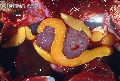 Amphilinidea body wormlike, not divided into proglottids.png