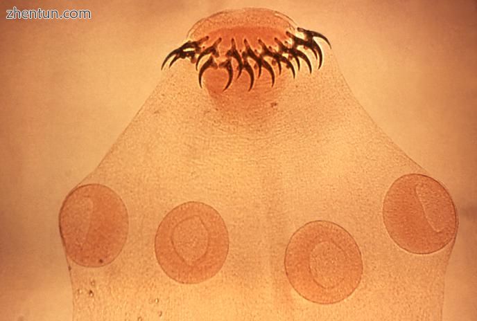 Scolex of Taenia solium with hooks and suckers..jpg