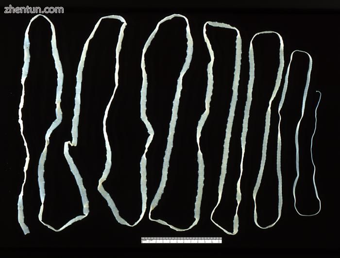 Taenia saginata.jpg