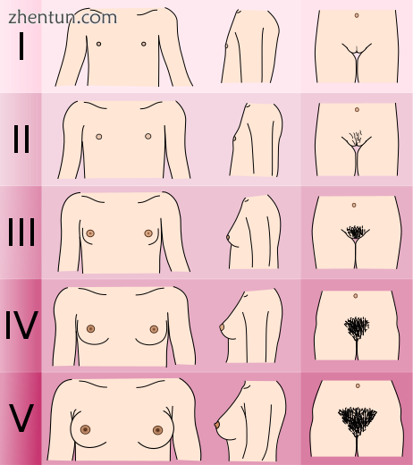 Five-stage Tanner Scale.png