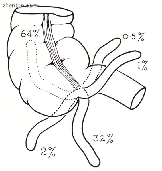 Drawing of colon with variability of appendix as seen from front.png