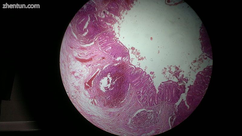 Histology of vermiform appendix.jpg