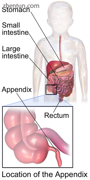 Illustration depicting the location of the appendix in a child.png