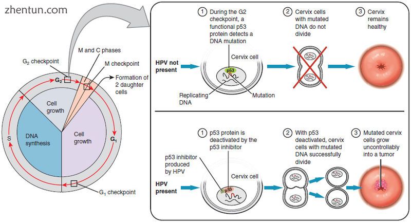 In most cases, cells infected with the HPV virus heal on their own. In some case.jpg