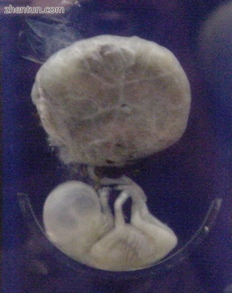 A human fetus, attached to placenta, at three months gestational age..jpg