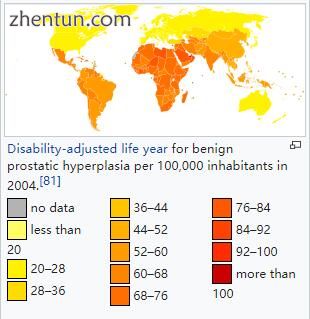 Disability-adjusted life year for benign prostatic hyperplasia per 100,000 inhab.jpg