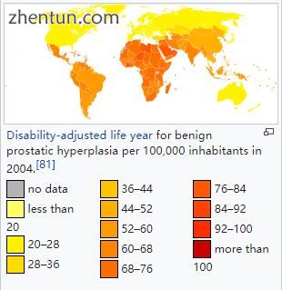 Disability-adjusted life year for benign prostatic hyperplasia per 100,000 inhab.jpg