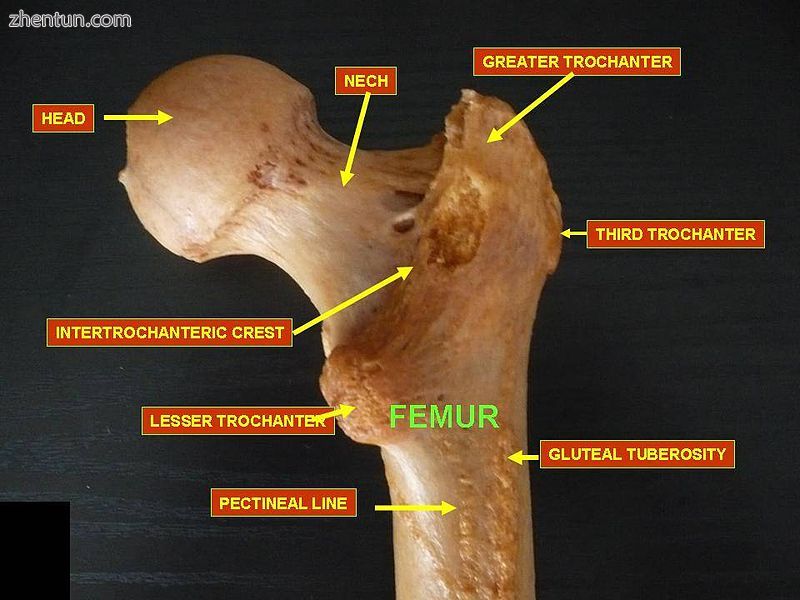 Femur neck. Posterior view..JPG