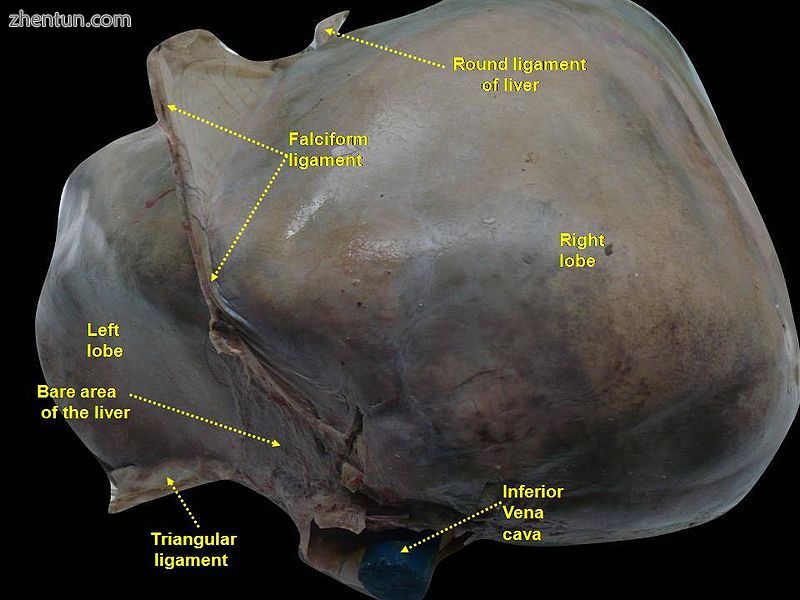 Bare area of the liver.Diaphragmatic surface of liver..JPG