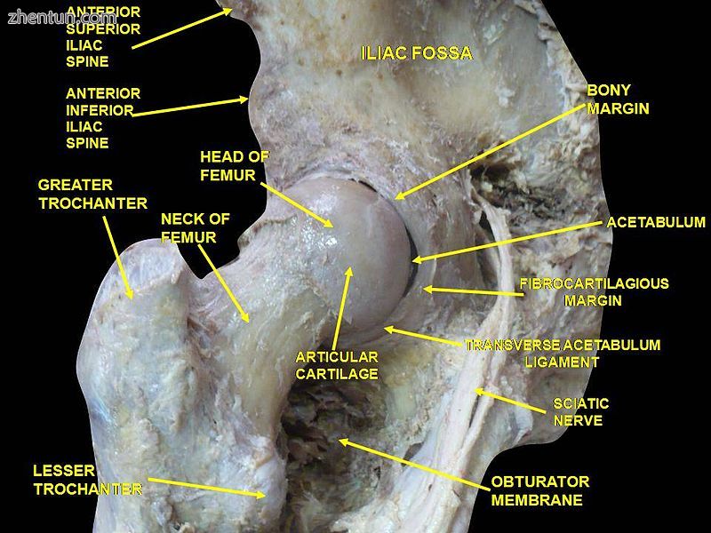 Hip joint. Lateral view.Greater trochanter..jpg