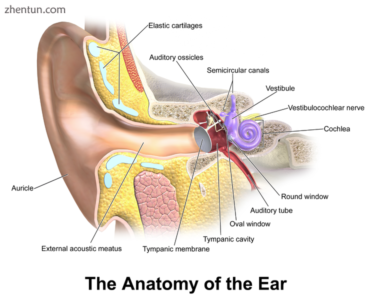 Right eardrum1 as seen through a speculum..png