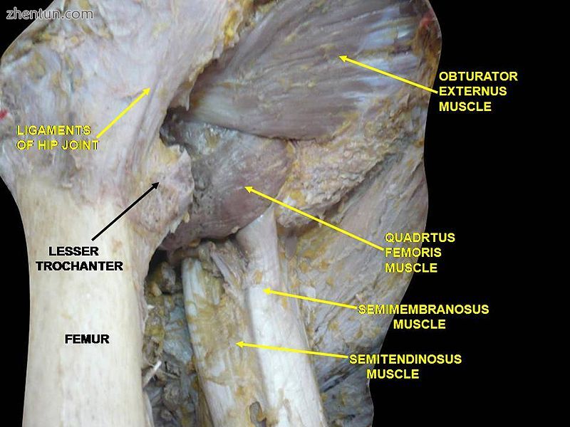 Muscles of Thigh. Anterior views..jpg