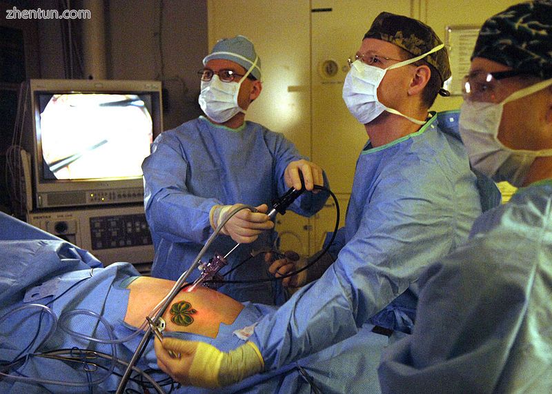 Surgeons perform a laparoscopic appendectomy..jpg