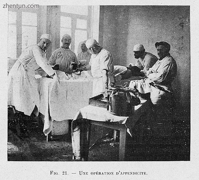 An appendectomy at the French Hospital in Tbilisi, Georgia, 1919.jpg