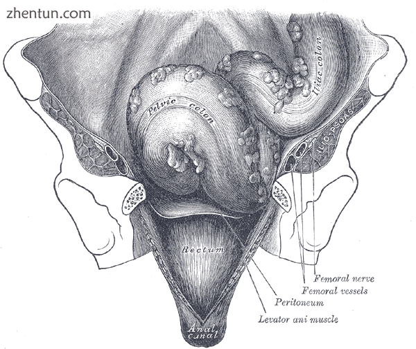 Iliac colon, sigmoid or pelvic colon, and rectum seen from the front, after remo.png