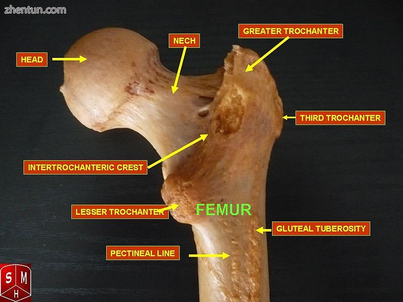 Human Right Femur. Posterior view, featuring third trochanter.jpg