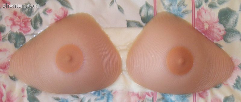 Breast prostheses used by some women after mastectomy.jpg