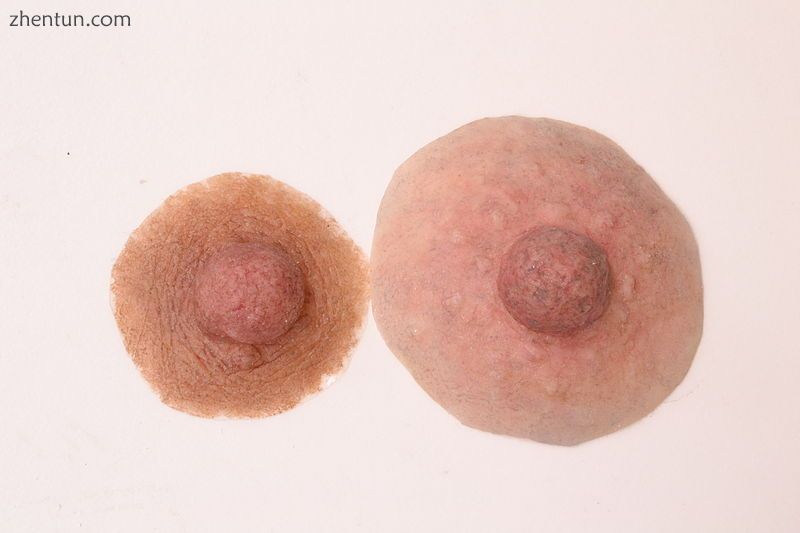 Examples of custom nipple prostheses.jpg