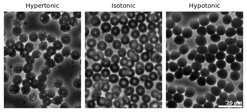 Micrographs of the effects of osmotic pressure.png