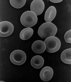 Scanning electron micrograph of human red blood cells (ca. 6–8 μm in diameter).jpg