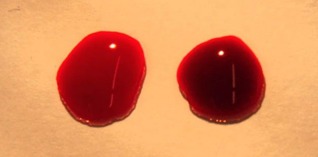 Two drops of blood are shown with a bright red oxygenated drop on the left and a.jpg